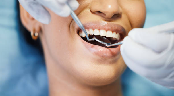 Best Emergency Dental Care for Abscessed Tooth in Lyman, WY